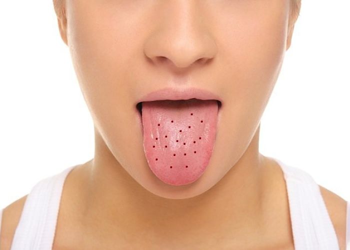puntos rojos lengua saludable